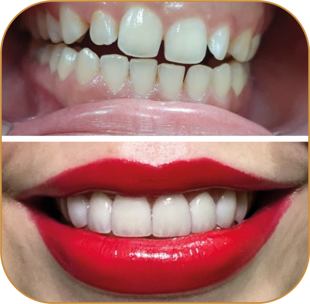COSMÉTICA DENTAL