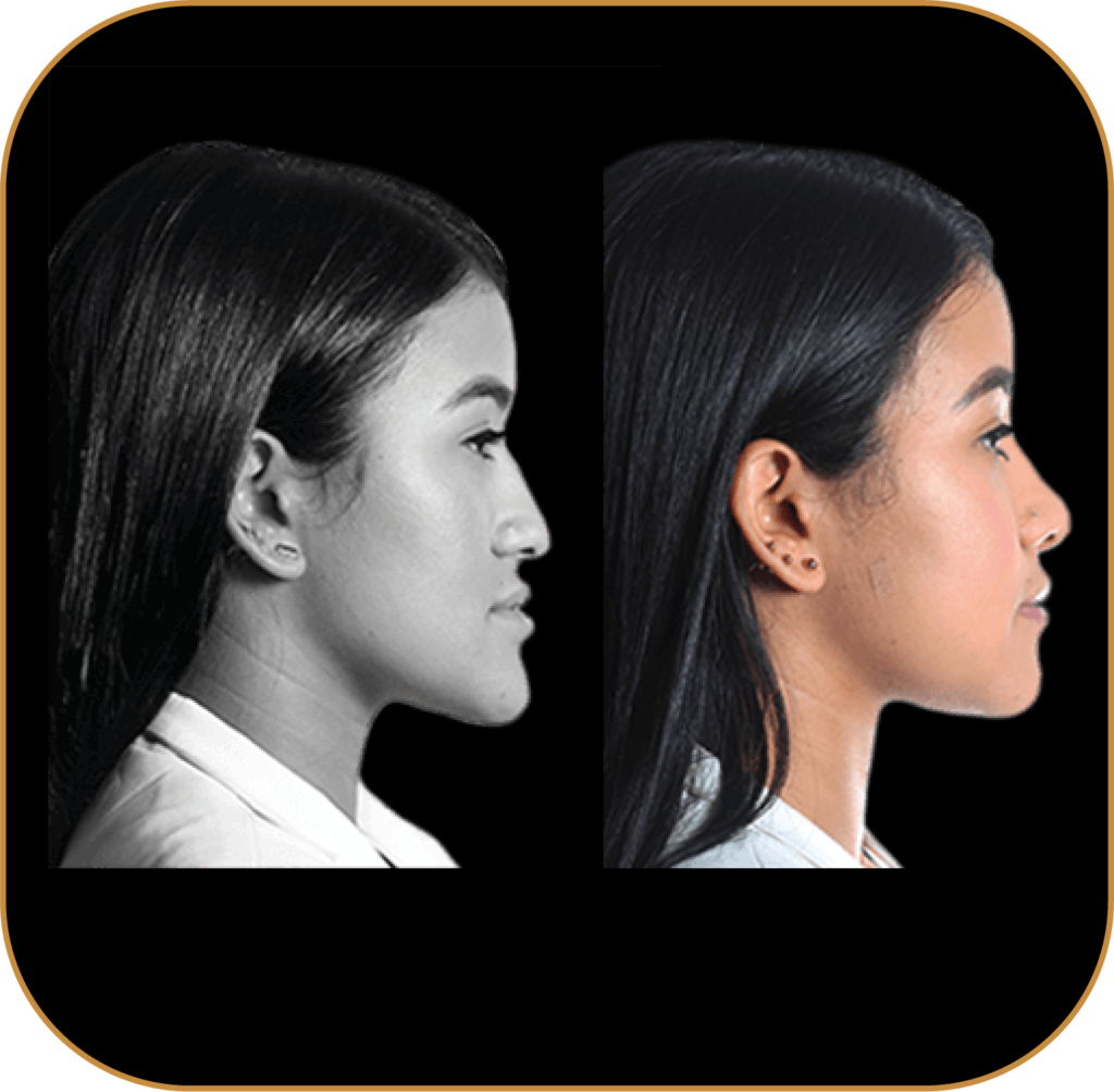 MAXILOFACIAL