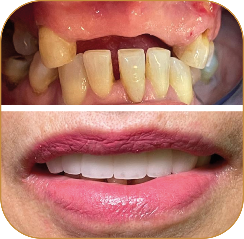 REHABILITACIÓN ORAL